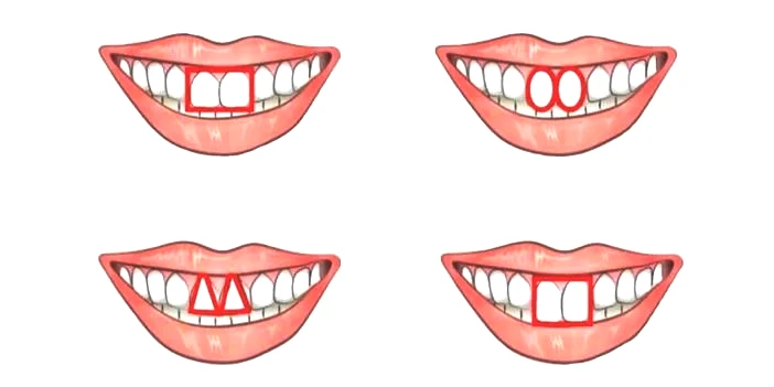 İşte Günün En İlginç Testi: Hipokrat'ın Geliştirdiği Teste Göre Bir İnsanı Ön Dişlerinden Nasıl Tanırsınız?