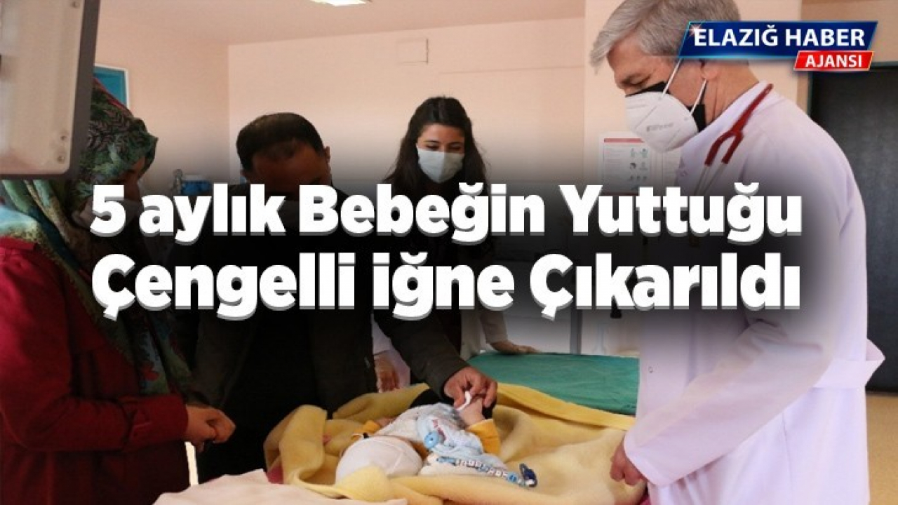 5 aylık bebeğin yuttuğu çengelli iğne operasyonla çıkarıldı