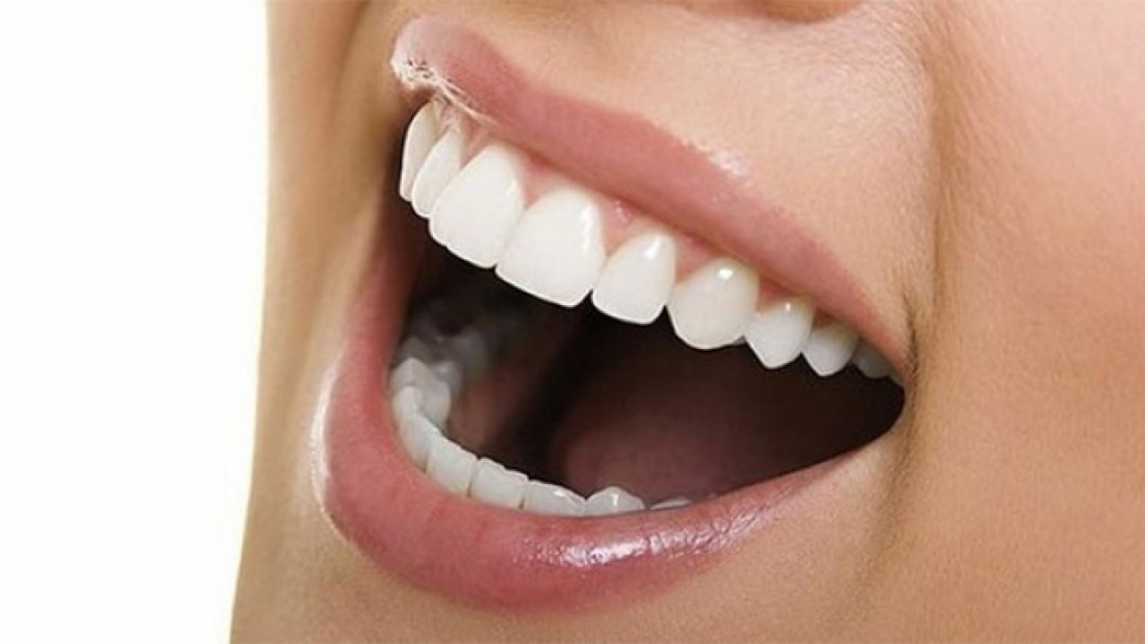 Telsiz ortodonti dönemi
